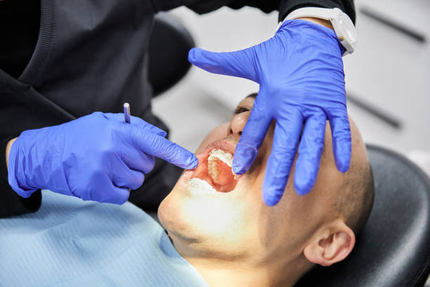 Best Emergency Dentist for Knocked-Out Tooth in Stanleytown, VA