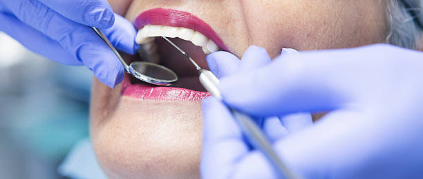 Best Emergency Dental Care for Abscessed Tooth in Stanleytown, VA